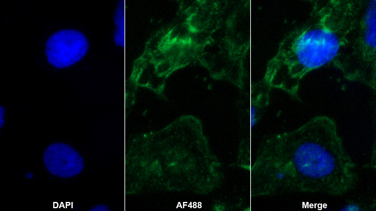 Monoclonal Antibody to Cross Linked C-Telopeptide Of Type I Collagen (CTXI)