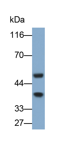 Monoclonal Antibody to Apolipoprotein E (APOE)