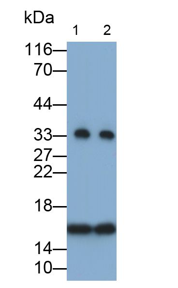 Monoclonal Antibody to Prealbumin (PALB)