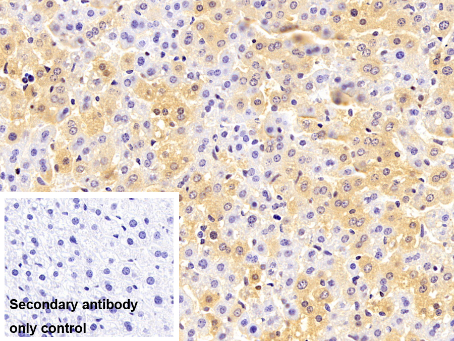 Monoclonal Antibody to Prealbumin (PALB)