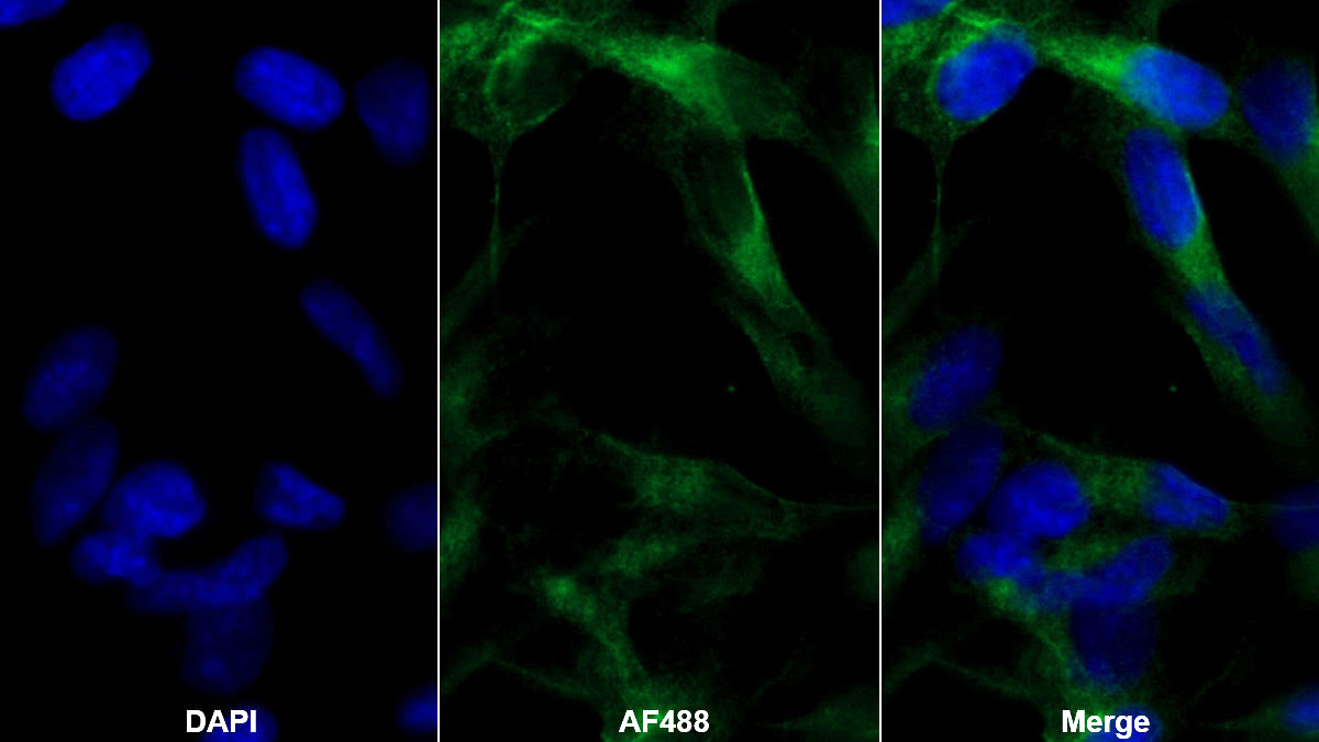 Monoclonal Antibody to Fibroblast Growth Factor 23 (FGF23)