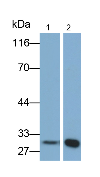 Monoclonal Antibody to Programmed Cell Death Protein 1 (PD1)