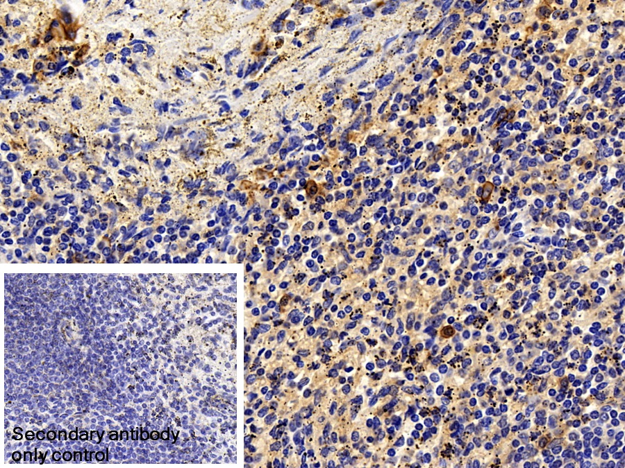 Monoclonal Antibody to Cluster Of Differentiation 38 (CD38)