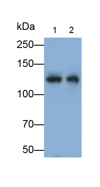 Monoclonal Antibody to Complement C3 Convertase (C3 Convertase)