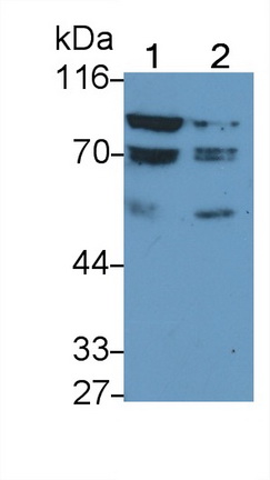 Monoclonal Antibody to Forkhead Box Protein P1 (FOXP1)