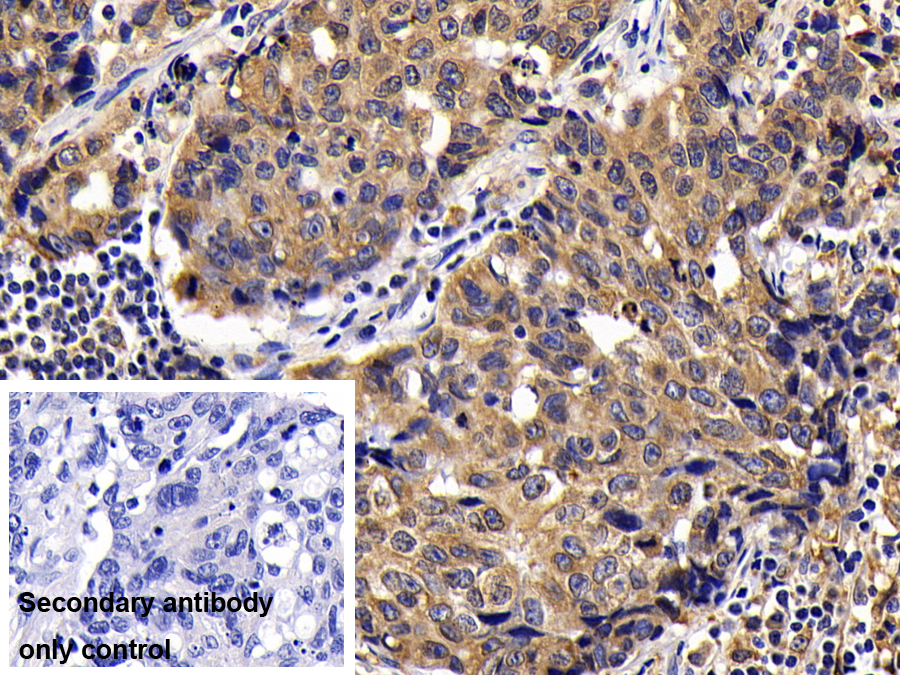 Monoclonal Antibody to B-Cell Leukemia/Lymphoma 2 (Bcl2)