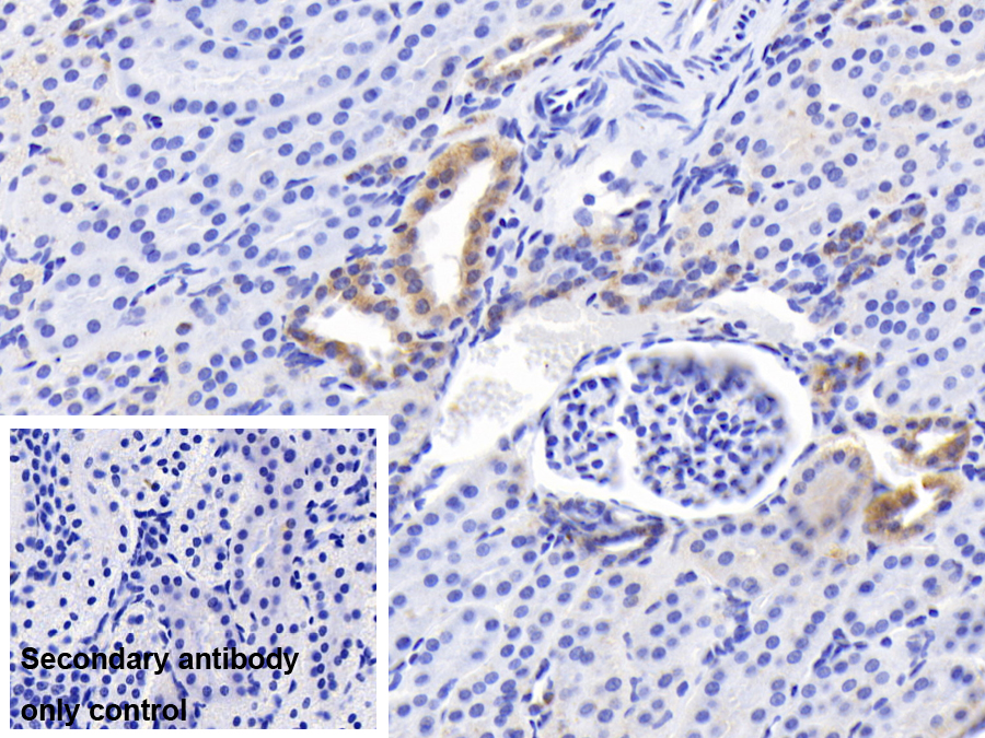 Monoclonal Antibody to B-Cell Leukemia/Lymphoma 2 (Bcl2)