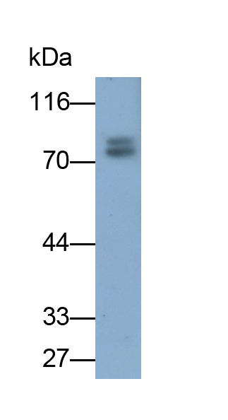 Monoclonal Antibody to Lactoferrin (LTF)