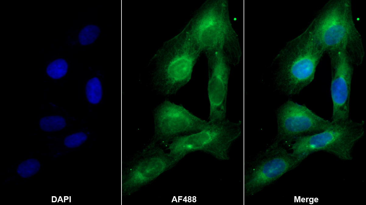 Monoclonal Antibody to Osteonectin (ON)