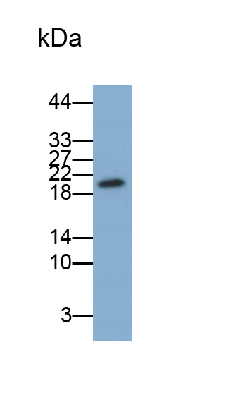 Monoclonal Antibody to Cyclin Dependent Kinase Inhibitor 2A (CDKN2A)