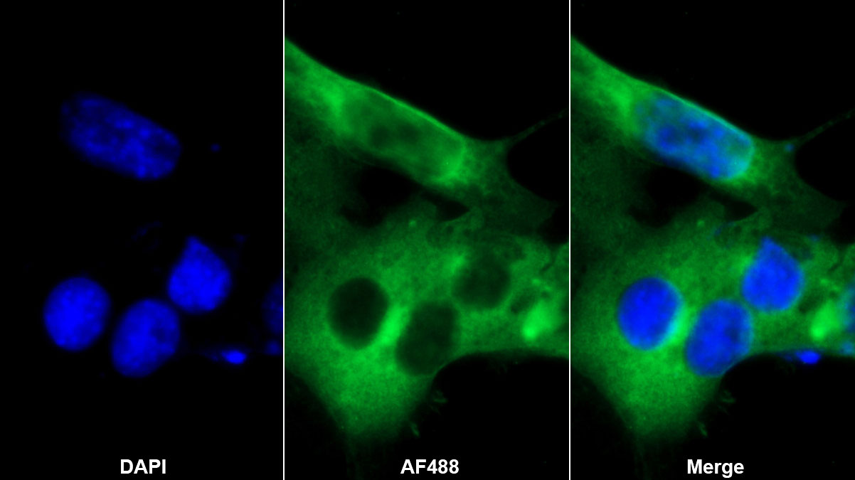 Monoclonal Antibody to Angiotensinogen (AGT)