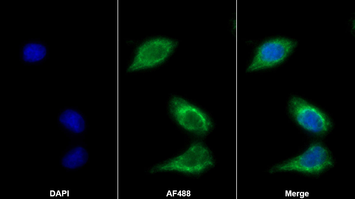 Monoclonal Antibody to Bone Morphogenetic Protein 7 (BMP7)