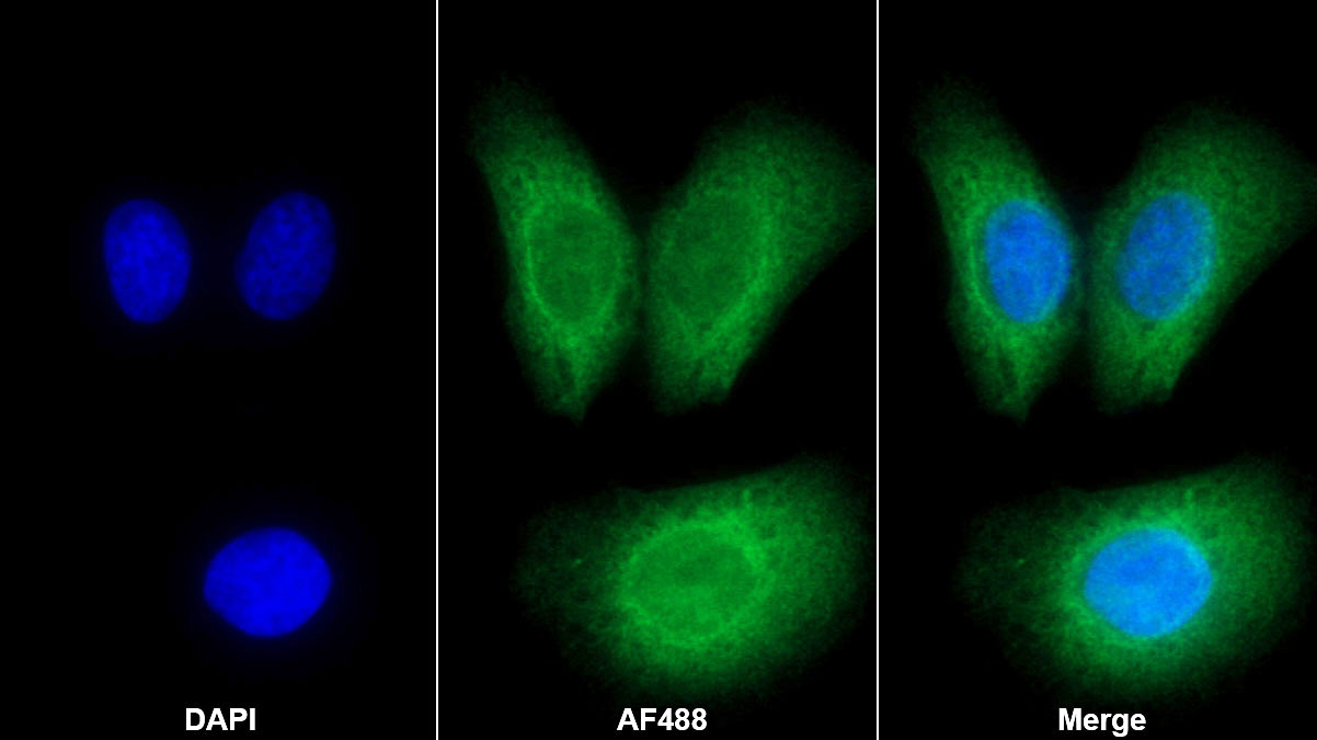 Monoclonal Antibody to Bone Morphogenetic Protein 7 (BMP7)