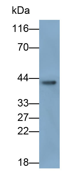 Monoclonal Antibody to Alpha-1-Acid Glycoprotein (a1AGP)