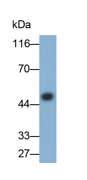 Monoclonal Antibody to Alpha-1-Acid Glycoprotein (a1AGP)