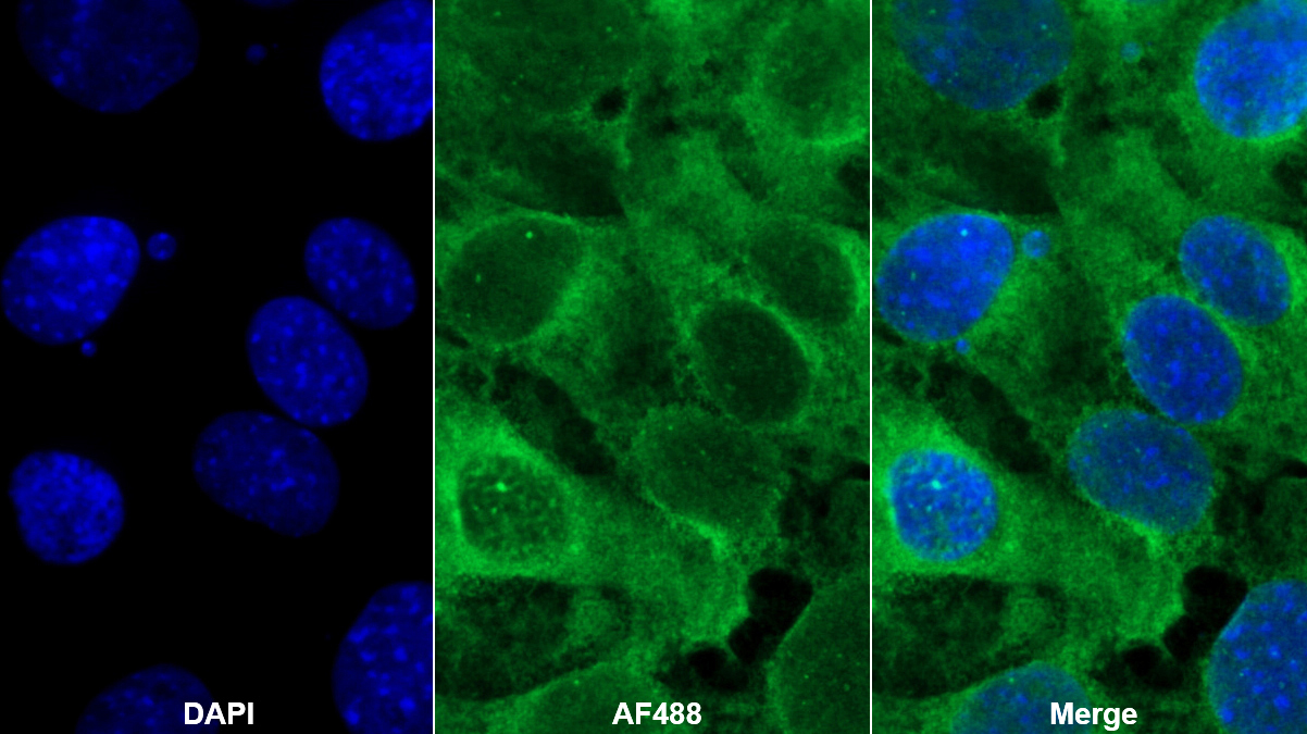 Monoclonal Antibody to Alpha-1-Acid Glycoprotein (a1AGP)