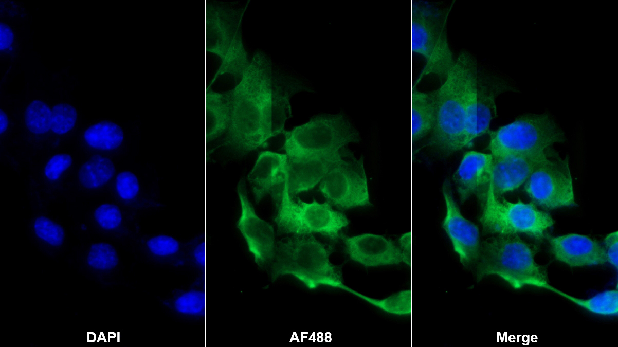 Monoclonal Antibody to Alpha-1-Acid Glycoprotein (a1AGP)