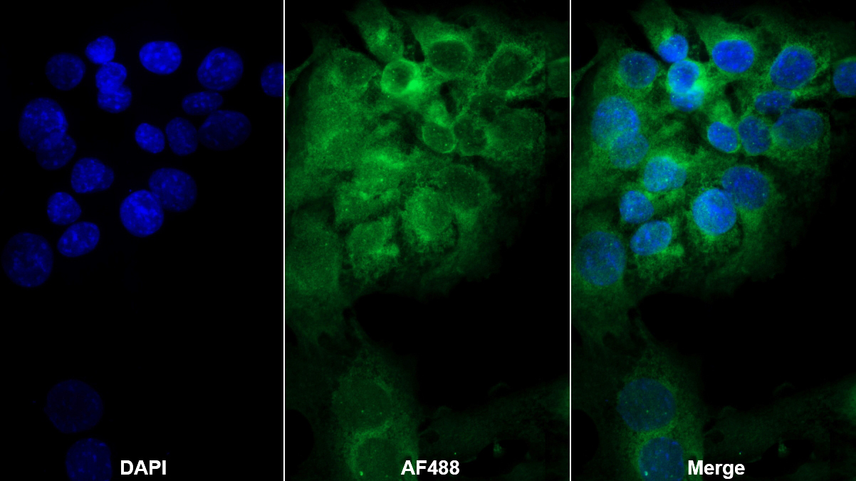 Monoclonal Antibody to Alpha-1-Acid Glycoprotein (a1AGP)