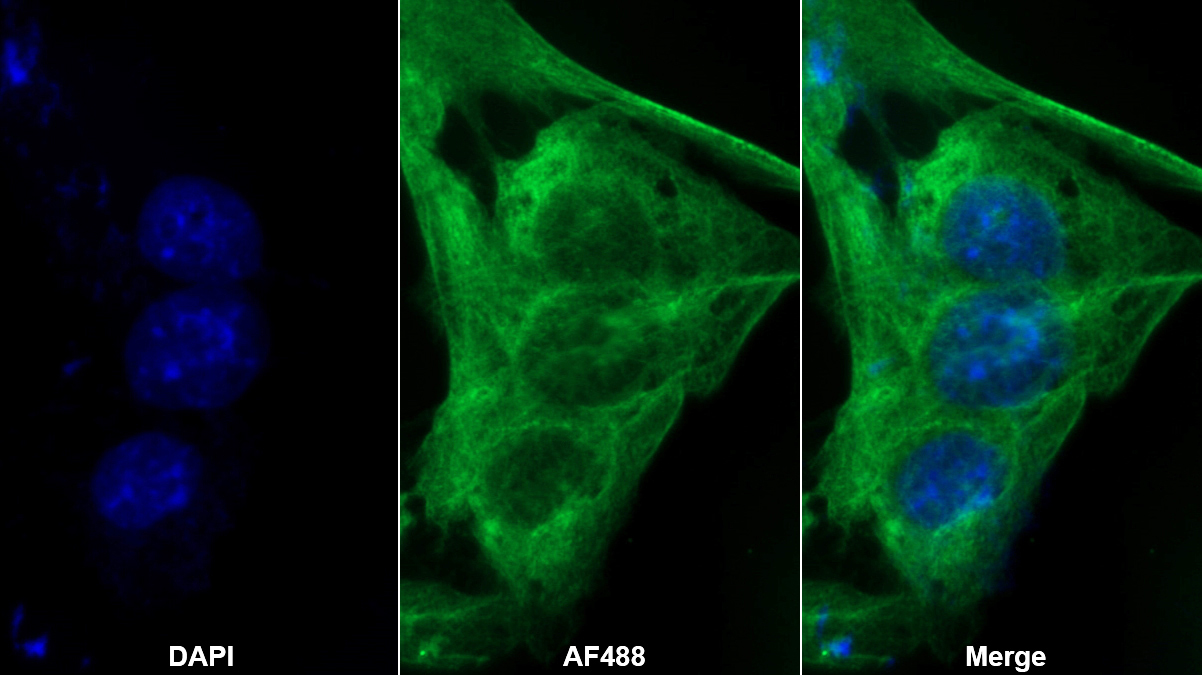 Monoclonal Antibody to Coagulation Factor II (F2)