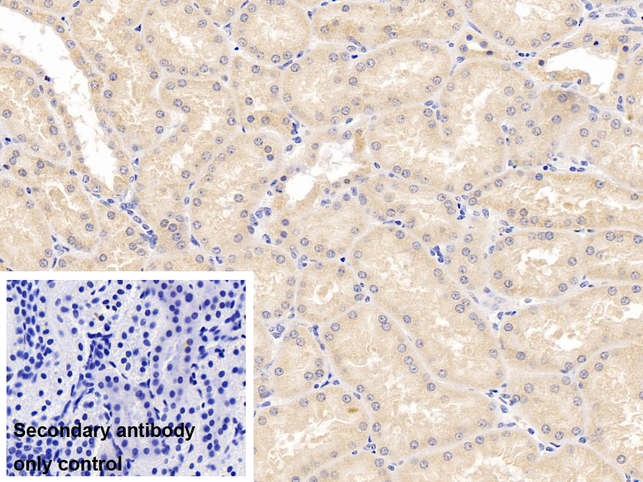 Monoclonal Antibody to Heat Shock Protein 60 (Hsp60)