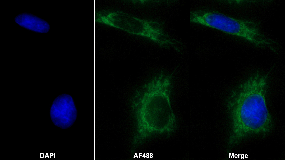 Monoclonal Antibody to Heat Shock Protein 60 (Hsp60)