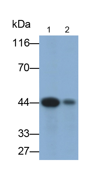 Monoclonal Antibody to Von Willebrand Factor (vWF)