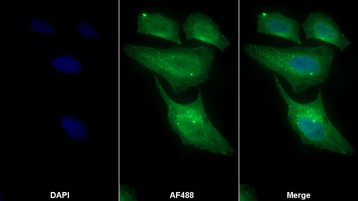 Monoclonal Antibody to Nitric Oxide Synthase 2, Inducible (NOS2)