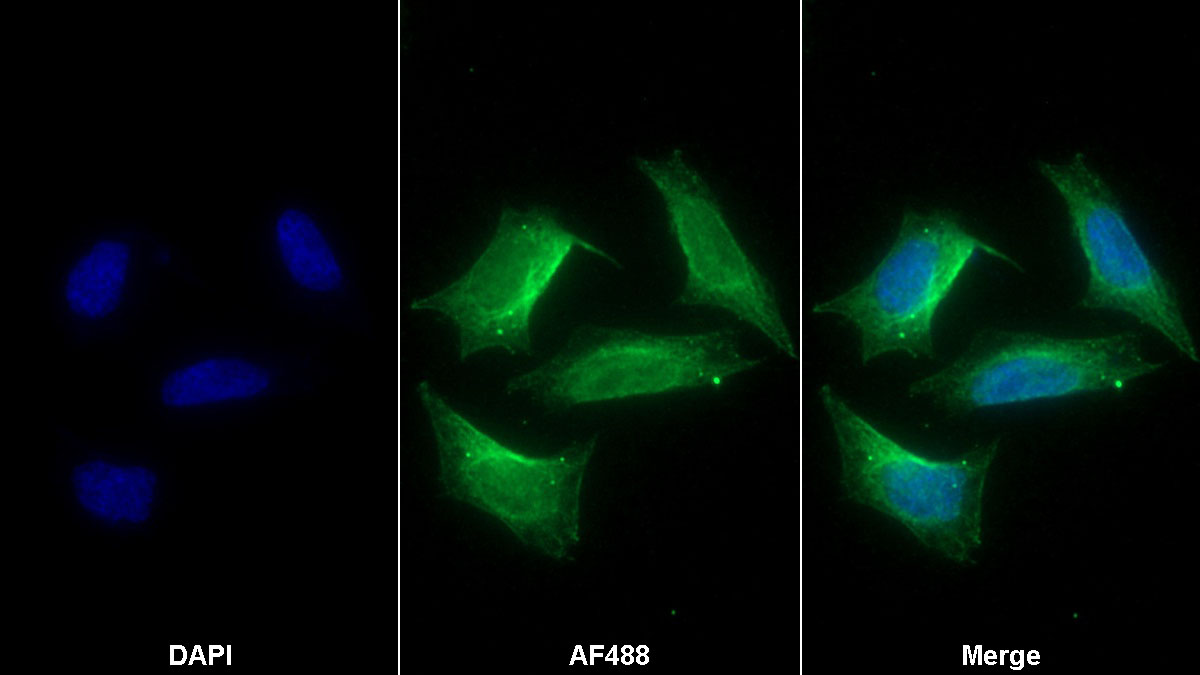 Monoclonal Antibody to Nitric Oxide Synthase 2, Inducible (NOS2)