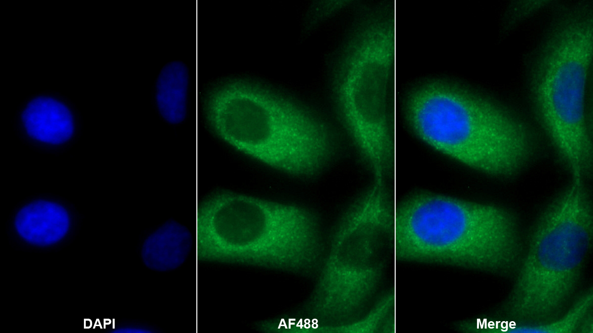 Monoclonal Antibody to Prolactin (PRL)