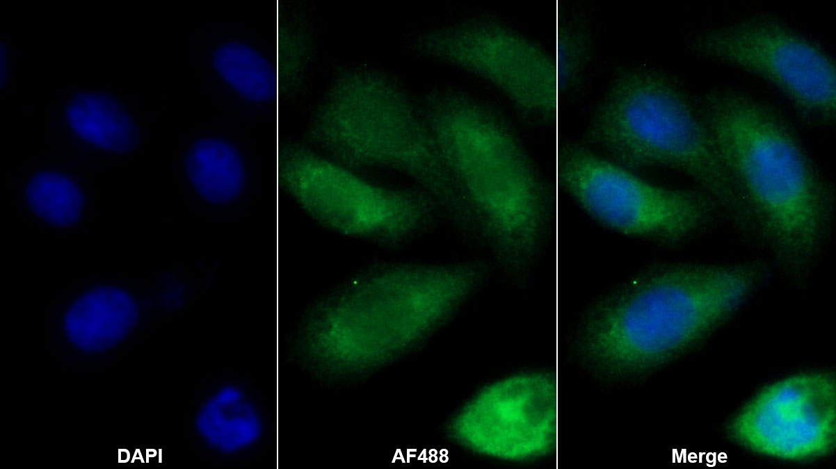 Monoclonal Antibody to Prolactin (PRL)