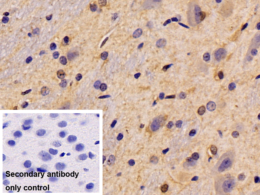 Monoclonal Antibody to Glycogen Phosphorylase, Liver (PYGL)