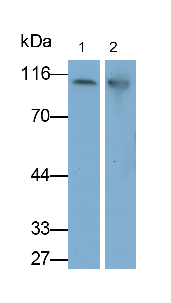 Monoclonal Antibody to Glycogen Phosphorylase, Liver (PYGL)