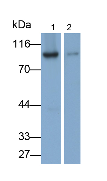 Monoclonal Antibody to Glycogen Phosphorylase, Liver (PYGL)