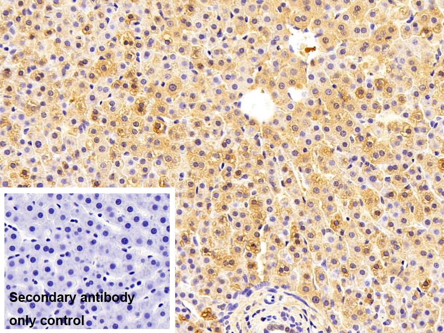 Monoclonal Antibody to Glycogen Phosphorylase, Liver (PYGL)