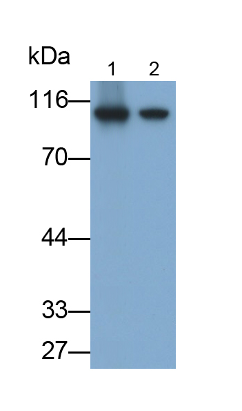 Monoclonal Antibody to Glycogen Phosphorylase, Liver (PYGL)