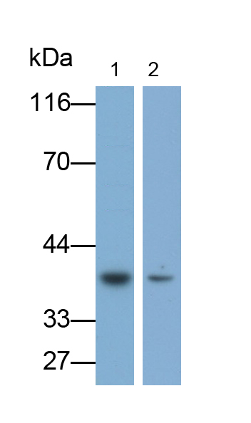 Monoclonal Antibody to Receptor Activator Of Nuclear Factor Kappa B Ligand (RANkL)