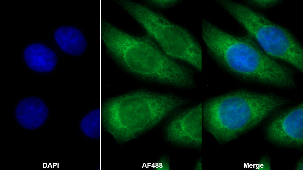 Monoclonal Antibody to Receptor Activator Of Nuclear Factor Kappa B Ligand (RANkL)