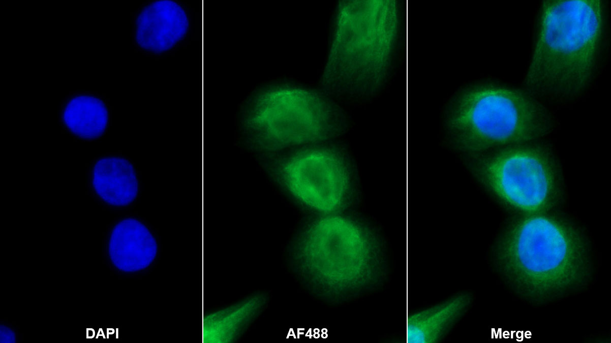 Monoclonal Antibody to Receptor Activator Of Nuclear Factor Kappa B Ligand (RANkL)