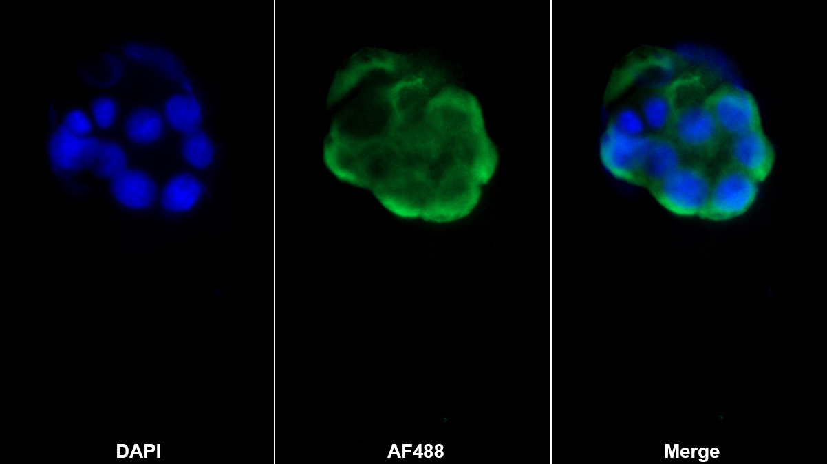 Monoclonal Antibody to Arachidonate-15-Lipoxygenase (ALOX15)