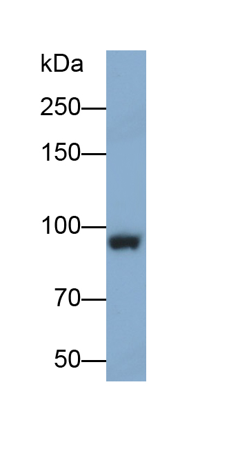 Monoclonal Antibody to Insulin Receptor (INSR)