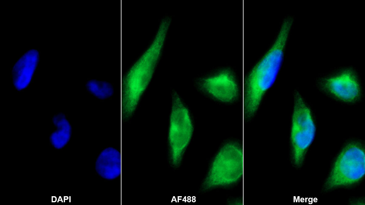 Monoclonal Antibody to Cystatin C (Cys-C)