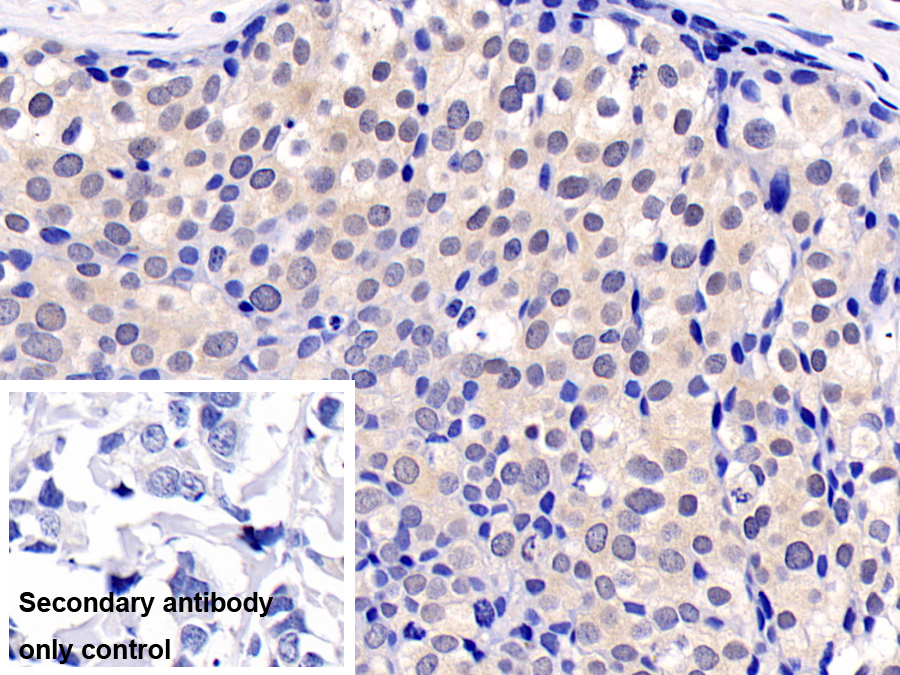 Monoclonal Antibody to Extracellular Signal Regulated Kinase 2 (ERK2)