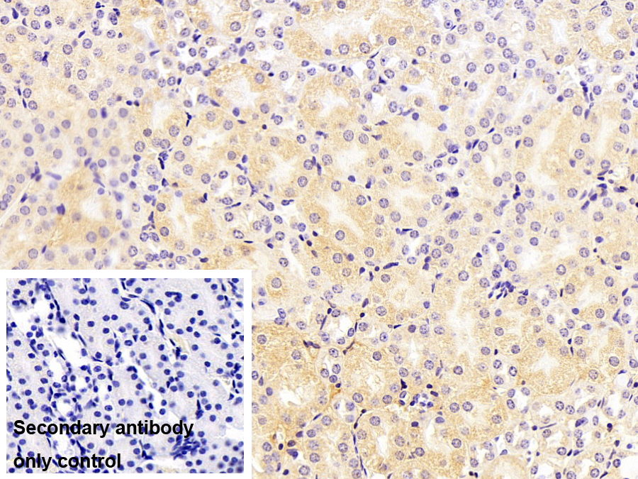 Monoclonal Antibody to Phosphoenolpyruvate Carboxykinase 1, Soluble (PCK1)