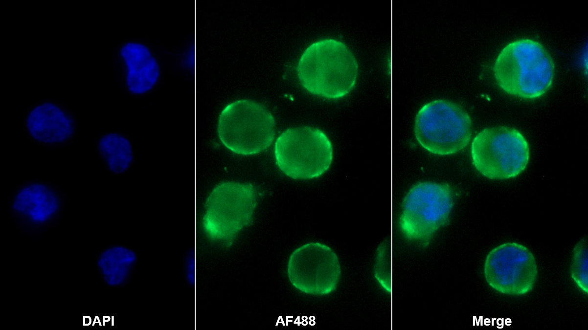 Monoclonal Antibody to Nephrin (NPHN)