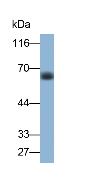 Monoclonal Antibody to Chemokine C-X-C-Motif Receptor 4 (CXCR4)