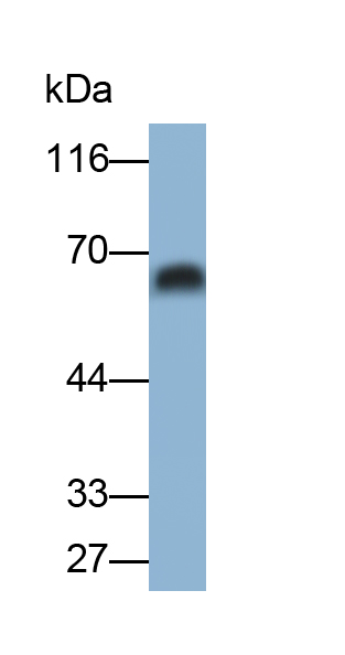 Monoclonal Antibody to Chemokine C-X-C-Motif Receptor 4 (CXCR4)