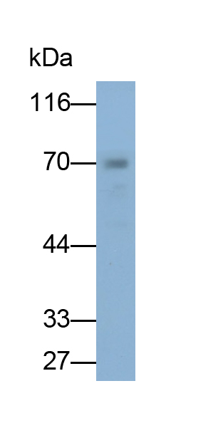 Monoclonal Antibody to Chemokine C-X-C-Motif Receptor 4 (CXCR4)