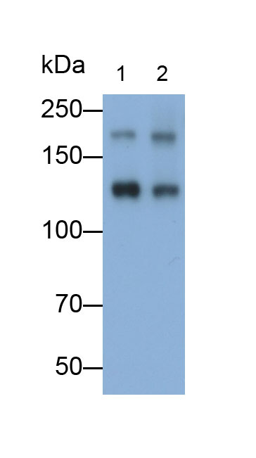Monoclonal Antibody to L1-Cell Adhesion Molecule (L1CAM)