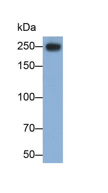 Monoclonal Antibody to L1-Cell Adhesion Molecule (L1CAM)