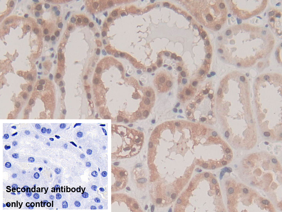 Monoclonal Antibody to Cyclophilin A (CYPA)